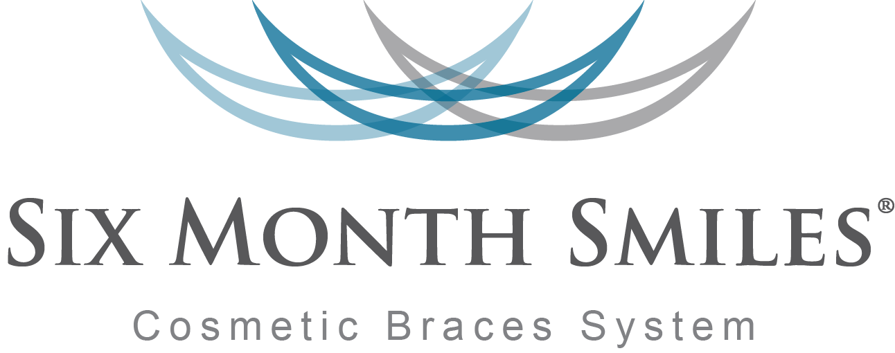 Six Month Smiles - Charlotte, NC - Fast Discreet Alternative To Metal Braces