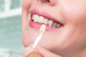 Smiling woman having porcelain veneers applied