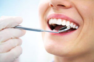 Dental Exam - Rochester Hills, MI - Dentist