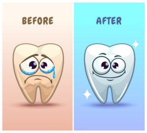 Cartoon of a tooth before and after tooth whitening