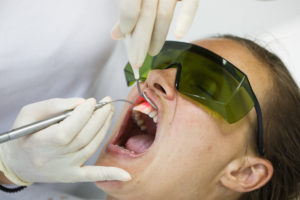 Woman undergoing laser dentsitry