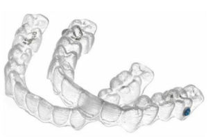 invisalign trays